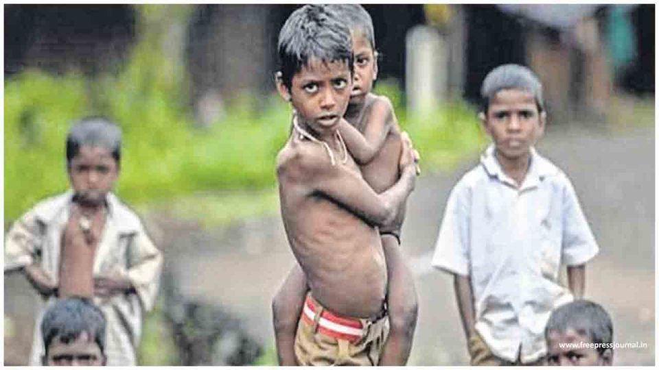 बिहार में लगातार जन्म ले रहे कुपोषित बच्चे