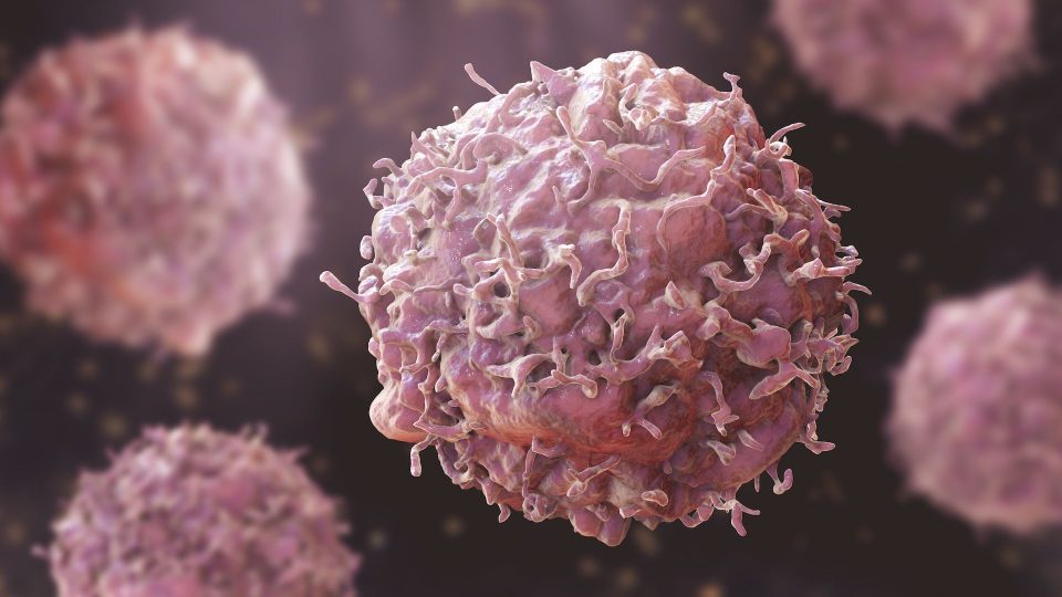Cancer: 28 राज्यों में इलाज का नेटवर्क बनाने का सुझाव